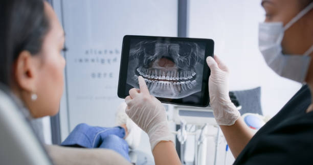 Licensed Dental service in Sonoma State University, CA - Smile Center Dentistry